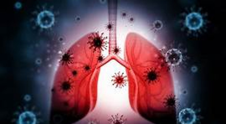 Image showcasing Respiratory Diseases As A Global Crisis: The Impact Of Air Pollution On ...